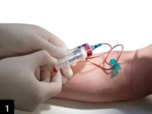 arthrex_prp_etape1 PRP (Platelet rich plasma)